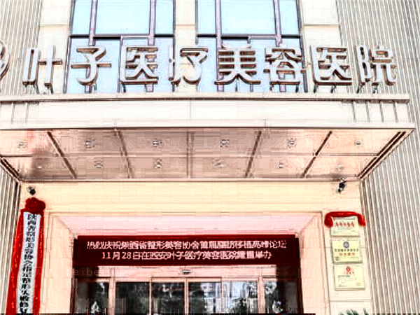 西安叶子祛斑哪个医生做得好_附医生名单