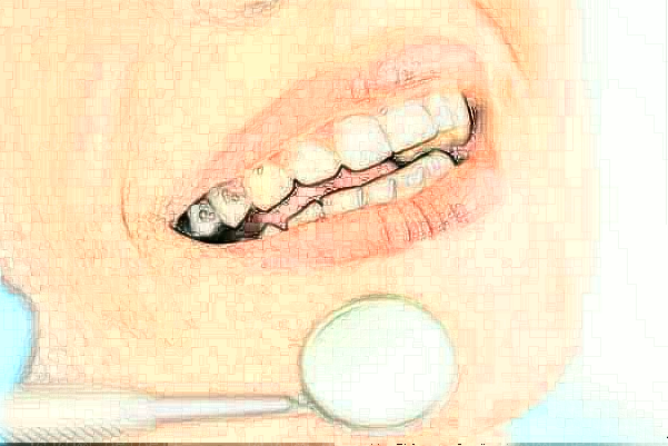 晋中市榆次区莱特口腔前牙种植专家信息一览_项目收费展示