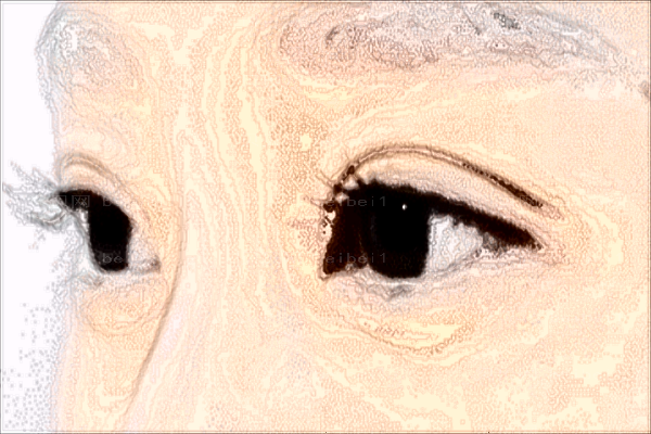 上海玫瑰开眼角怎么样?多少钱?整形价格一览