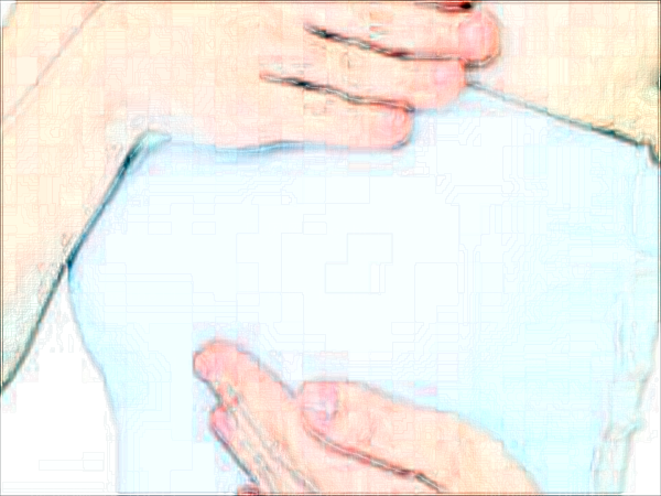 南昌佳美假体隆胸整形价格一览?有什么危害?