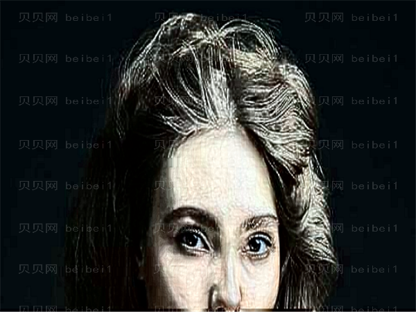 西安叶子去眼袋哪个医生做得好_附整形
