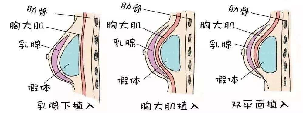 齐齐哈尔市有做丰胸假体医院吗?齐齐哈尔医学院附属第一医院和千百度做隆胸怎么样？当地排名榜前九名单
