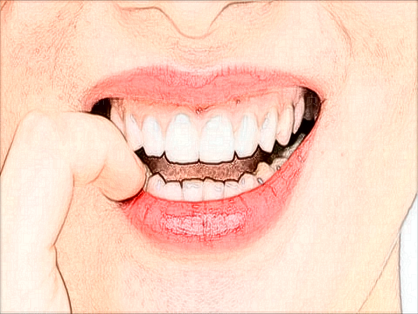 合肥华美牙齿矫正哪些医生好?医生名单公布