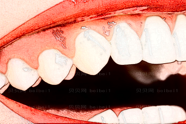 2022昆明雅度口腔半口种植做的怎么样_杨孟姜医生好不好