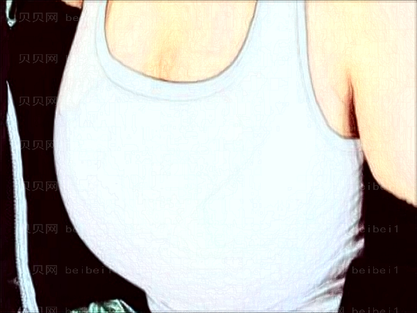 合肥华美去副乳整形价格一览?会留疤吗