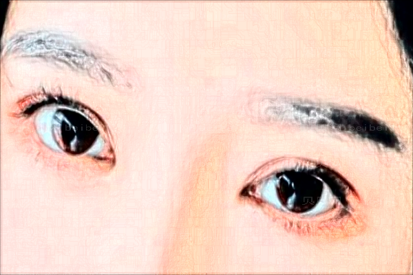 北京壹加壹眼部综合好吗?哪个医生好?