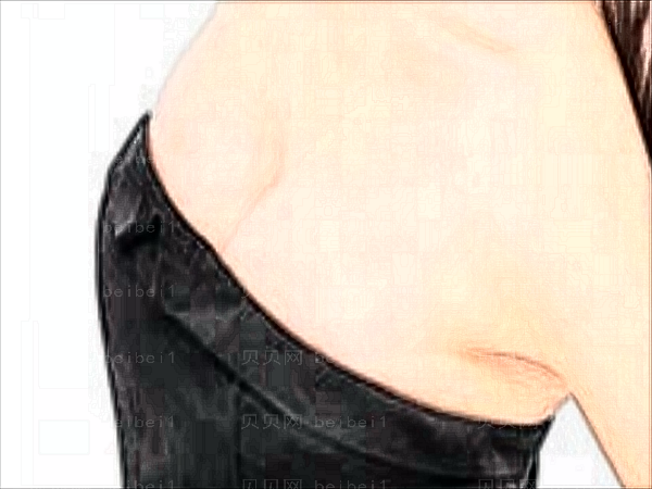 合肥华美去副乳哪个好?去副乳医生介绍?