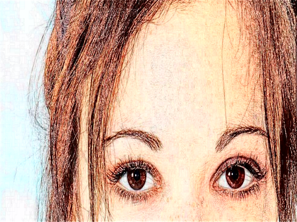 北京画美医疗美容双眼皮整形怎么样?做双眼皮的医生有哪些?