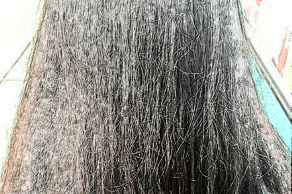成都恒美毛发医疗美容医院种植发际线哪个医生比较好?发际线种植多久可以恢复自然?