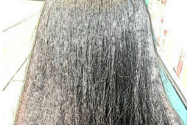 加密植发会伤原生发吗?南明发博士医疗美容门诊部加密植发靠谱吗?