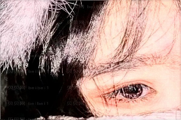 上海艺星眼部修复整形价格一览,来看看做的好吗?