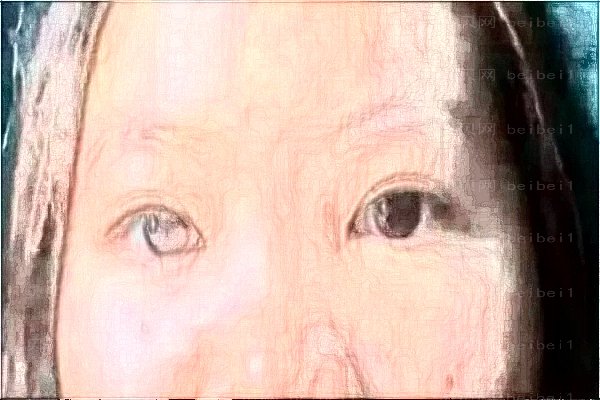 上海艺星眼部修复整形价格一览,来看看做的好吗?