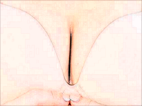 广州可玉假体隆胸医生好吗?医生名单