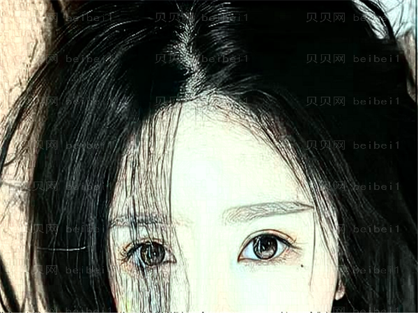 重庆美圣美邦卧蚕填充医生名单！附医院介绍