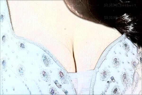 南昌巨乳缩小整形医生谁做的好?来看看这份介绍