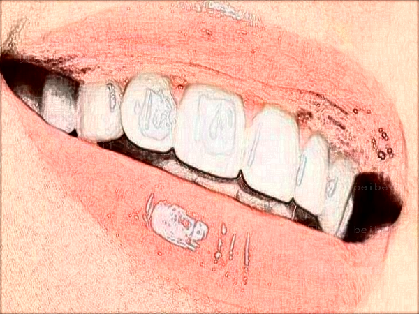 牙齿矫正和正畸是一个意思吗?牙齿矫正和种牙哪个好