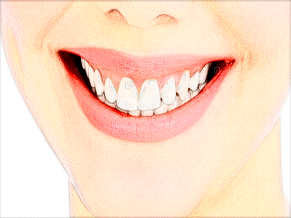 牙齿矫正和正畸是一个意思吗?牙齿矫正和种牙哪个好