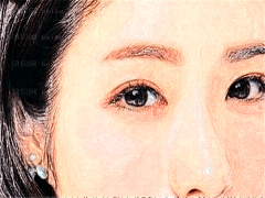 深圳源美去鱼尾纹好吗?专家口碑介绍