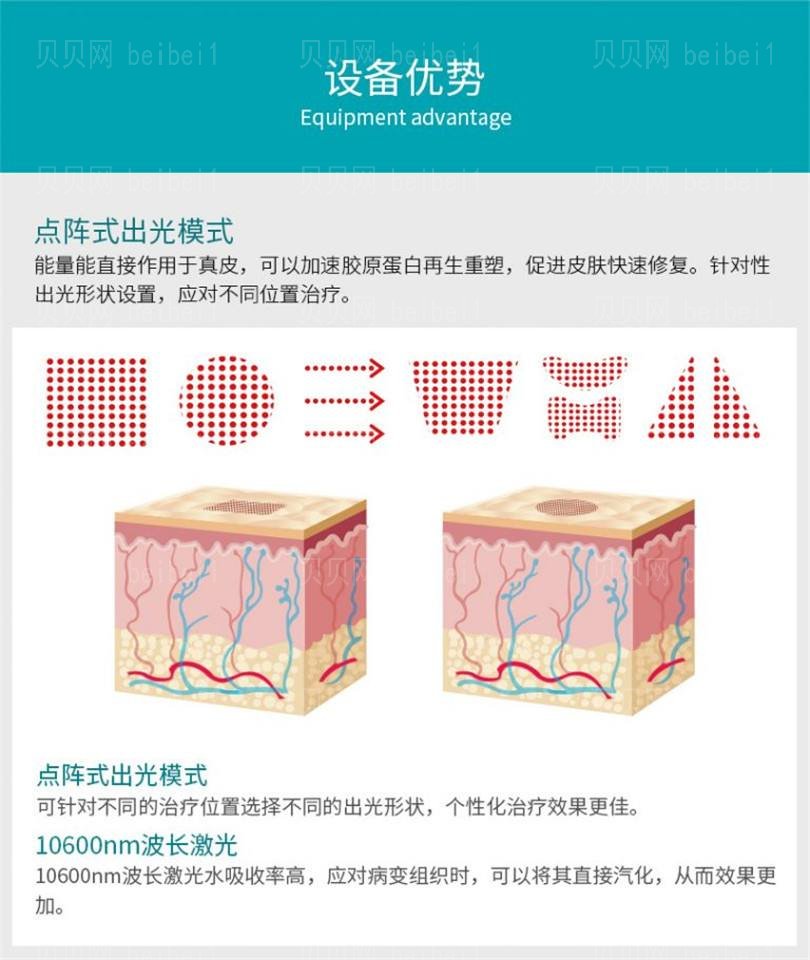 苏州大学一附院点阵激光价格