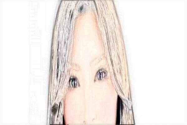 广西爱思特丰泪沟收费贵不贵?整形价格一览
