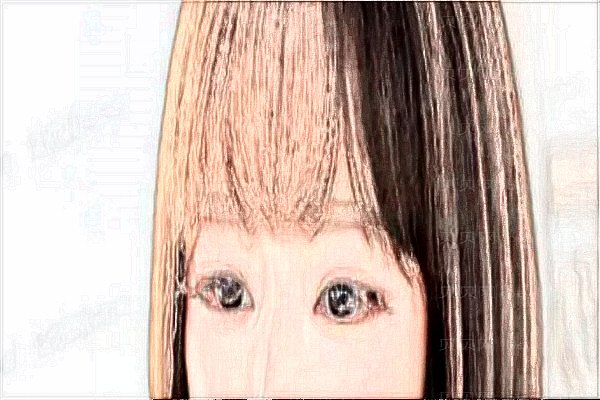 广西爱思特丰泪沟收费贵不贵?整形价格一览