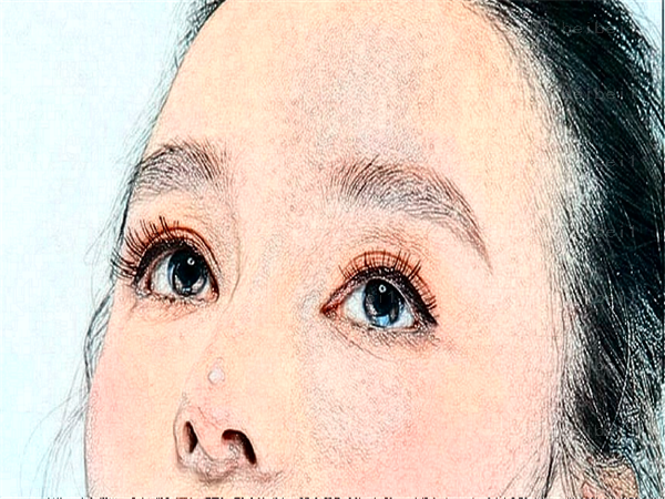 柳州丽人医院垫鼻尖有什么优势?附排名靠前的医生
