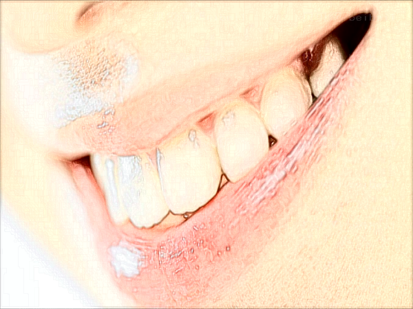 龅牙矫正可以改良凸嘴吗?龅牙矫正可以改良法令纹吗