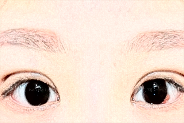 成都铜雀台开眼角哪种好?附整形价格一览