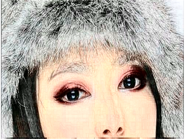 开眼角怎么做的?开眼角多久能恢复好?