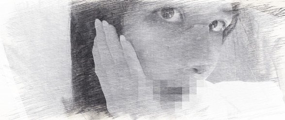 成都西区医院肋软骨隆鼻+歪鼻矫正介绍分享【价格】