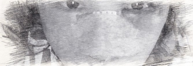成都西区医院肋软骨隆鼻+歪鼻矫正介绍分享【价格】