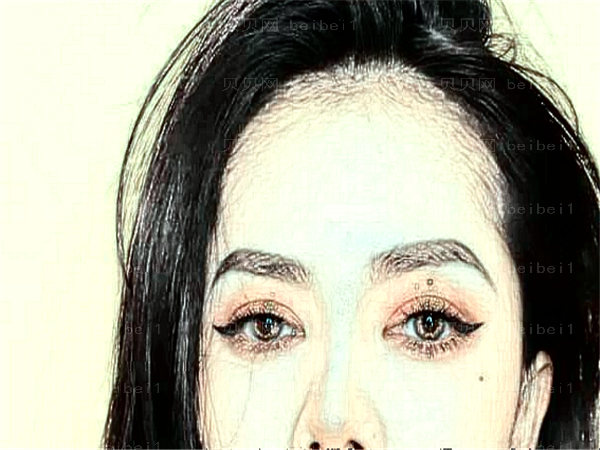 武汉洪山德美眼部修复怎么样?实力怎么样?