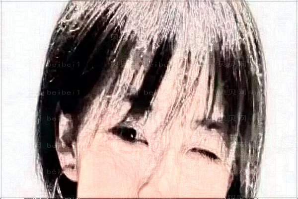 激光祛红血丝要多少钱?激光祛红血丝要做几次