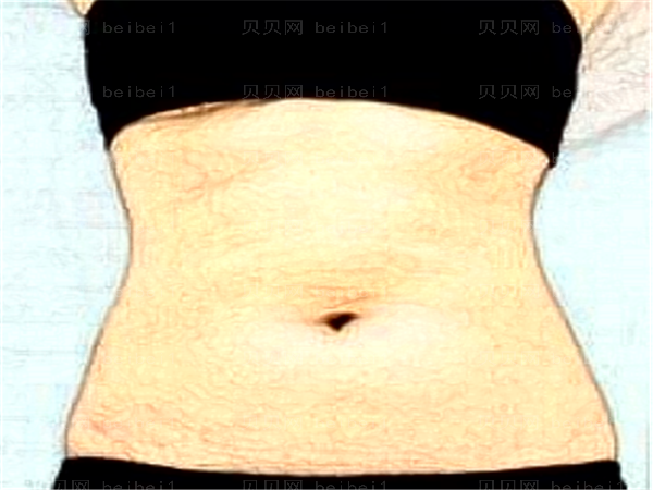长治亮丽腰腹环吸价格_医生名单一览