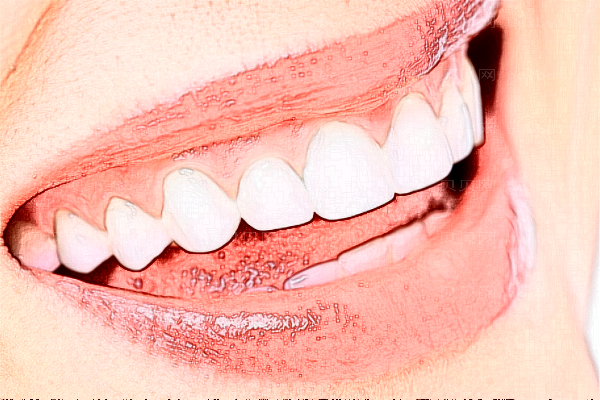 喷砂洁牙能治牙黄吗?喷砂洁牙能保持多久