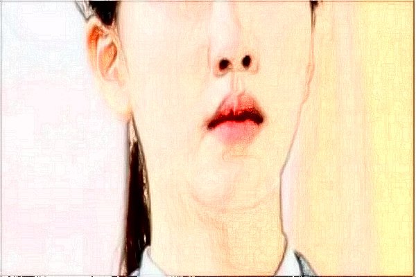 上海伯思立鼻部修复做的怎么样_价格报更新!