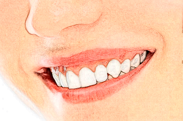 牙齿美白会敏感吗?牙齿美白会恢复黄牙吗