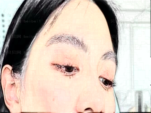 宁波去黑眼圈整形专家介绍_前六医生名单一览