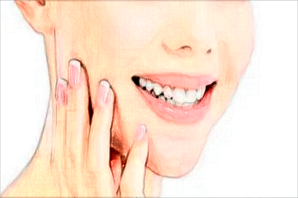 牙齿美白需要做几次?牙齿美白要注意什么