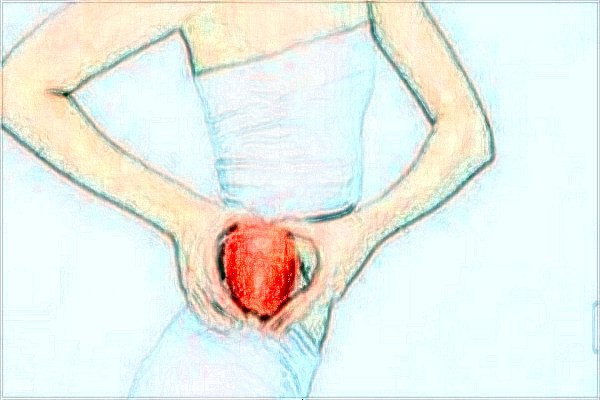 去妊娠纹有什么办法?去妊娠纹有副作用吗