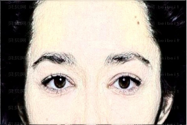 长沙丽都全脸填充价格贵吗(医生谁做的比较好)
