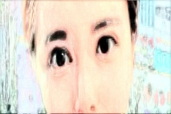 北京亚楠容悦除皱瘦脸医生哪些好?附整形价格一览