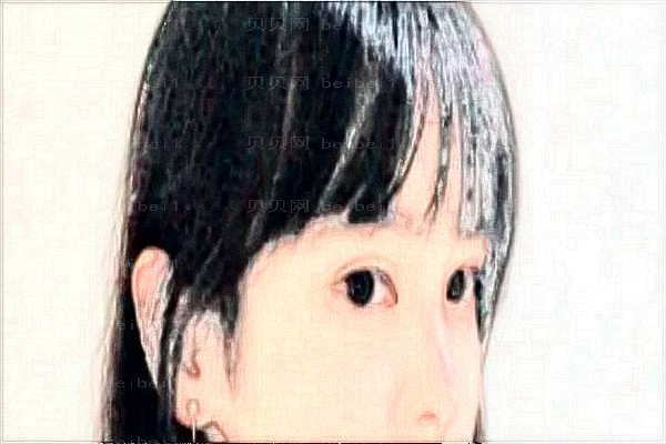 去胎记要多长时间?去胎记要多久恢复