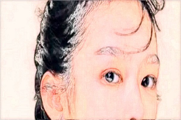 成都忠爱美成除皱瘦脸价目一览2022!附专家介绍