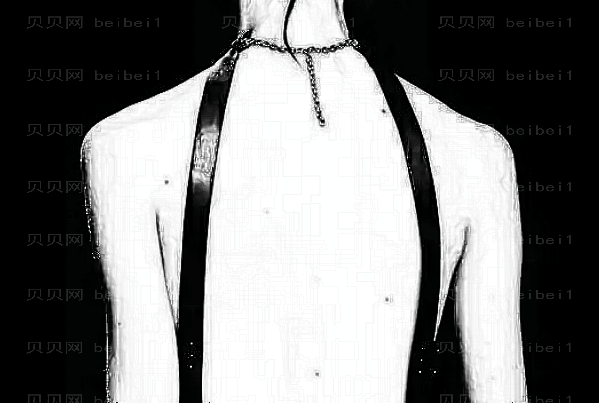 背部吸脂要多久能恢复?背部吸脂要穿塑身衣吗