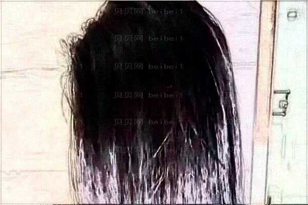 上海大麦微针植发怎么样?方建文医生,付华刚医生谁做得好