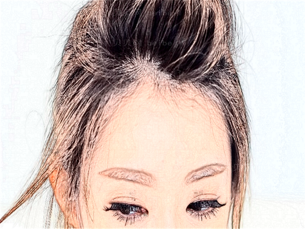 成都碧莲盛植发哪位医生好?专家排名详解