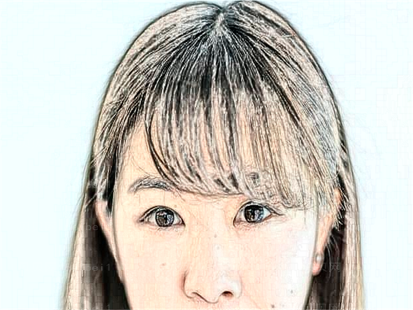 临沂去痘印整形专家介绍_前四名单一览