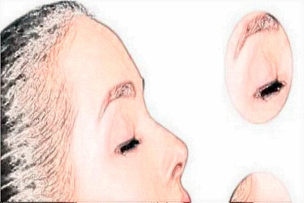 南昌南大切开双眼皮比较好的医生?专家盘点出炉