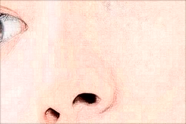 北京米扬丽格硅胶隆鼻可以维持多久?附整形价格一览